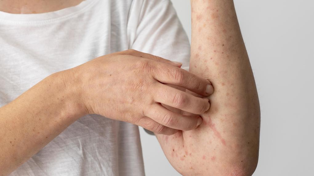 Consumidora sofre lesões após uso de produtos da Mary Kay