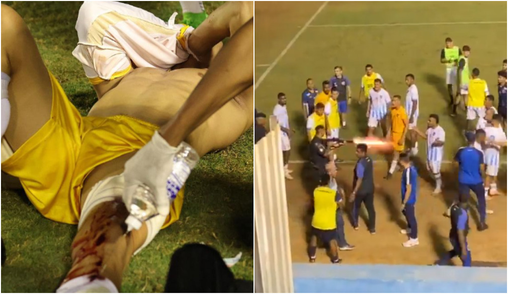 Ministério do Esporte repudia tiro de PM em goleiro: ‘Ação desproporcional e violenta’ Ministério do Esporte repudia tiro de PM em goleiro: ‘Ação desproporcional e violenta’