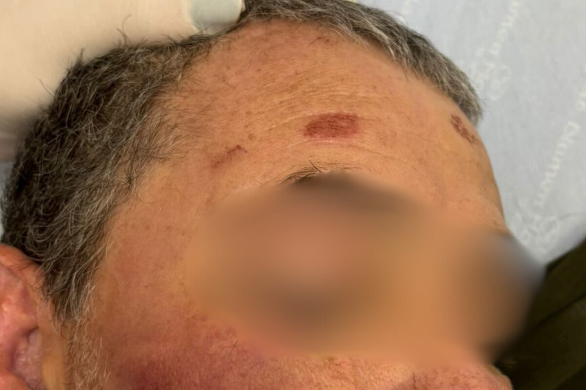 Morte em clínica: monitor que torturou paciente já desafiou PM na rua Morte em clínica: monitor que torturou paciente já desafiou PM na rua