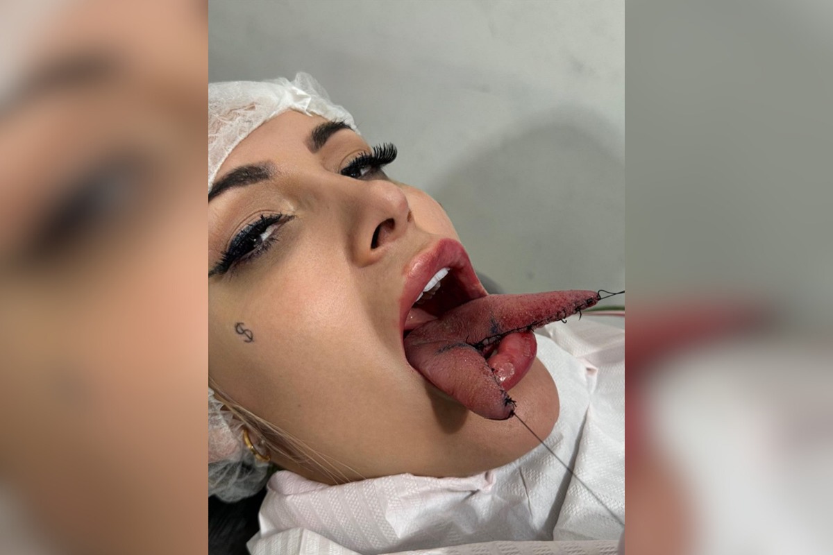 Saiba valor que Andressa Urach pagou para ficar com “língua de cobra” Saiba valor que Andressa Urach pagou para ficar com “língua de cobra”