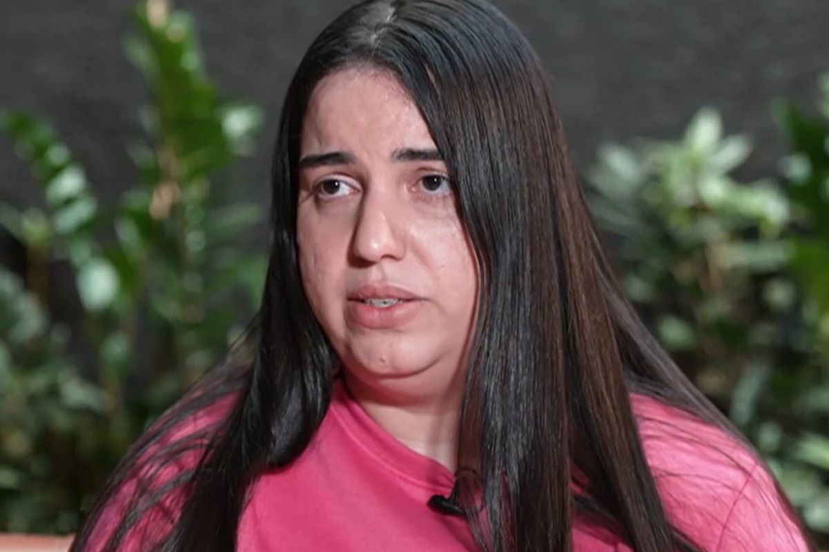 Peeling de fenol: Justiça nega pedido de sigilo feito por influencer Peeling de fenol: Justiça nega pedido de sigilo feito por influencer