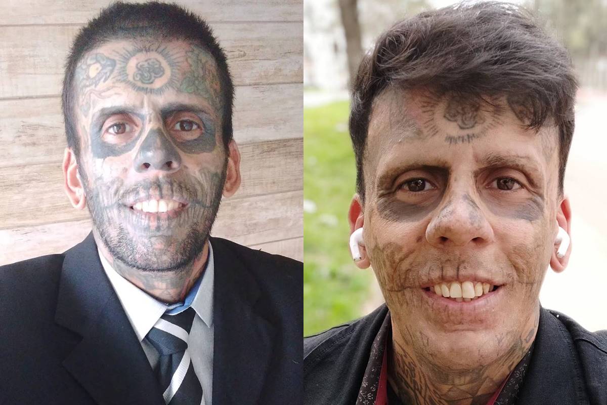 Convertido, homem mais tatuado do Brasil começa a remover tatuagens Convertido, homem mais tatuado do Brasil começa a remover tatuagens