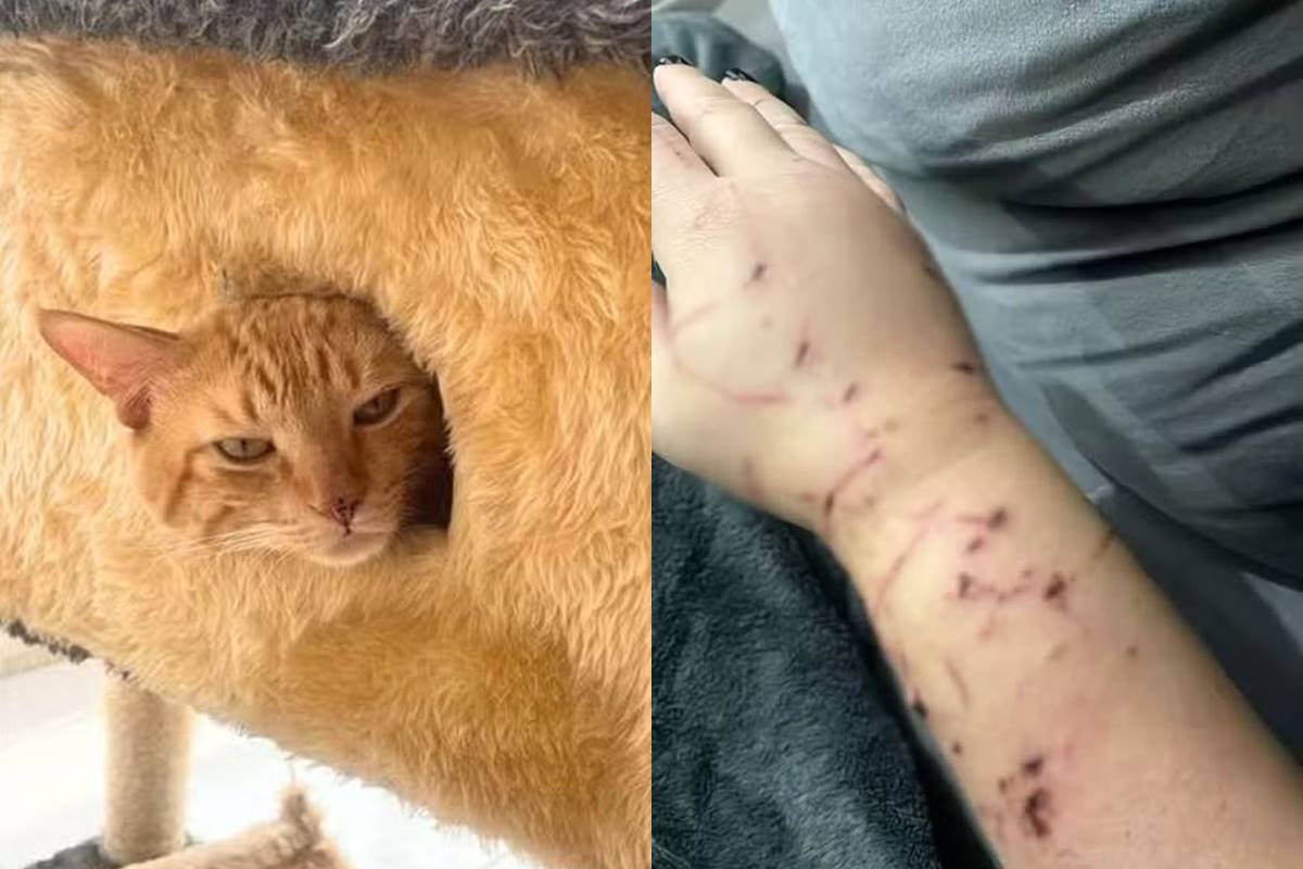 Gato que dilacerou braço de tutora no litoral tem histórico de ataques Gato que dilacerou braço de tutora no litoral tem histórico de ataques