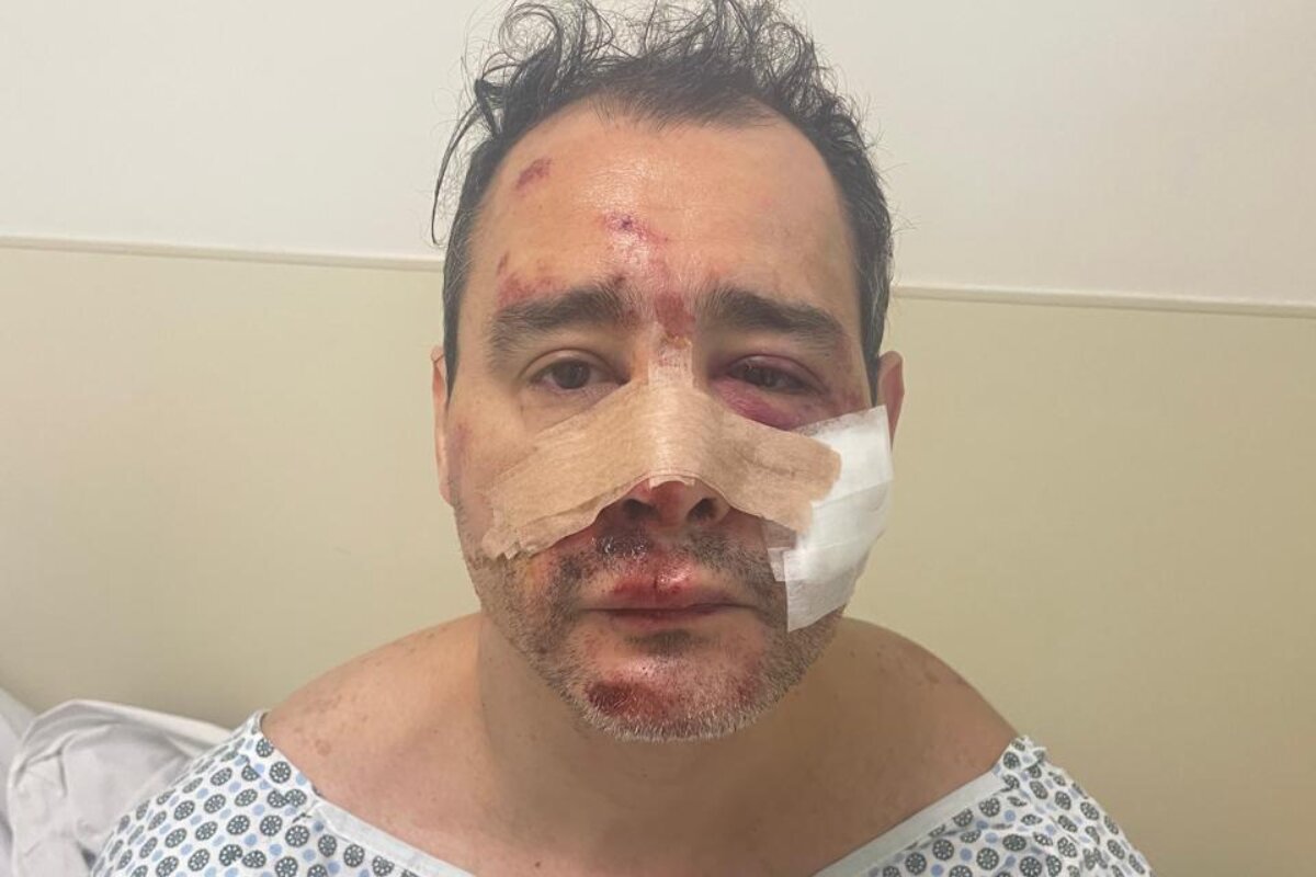 Metalúrgico é espancado com barra de ferro por causa de xixi de cão Metalúrgico é espancado com barra de ferro por causa de xixi de cão
