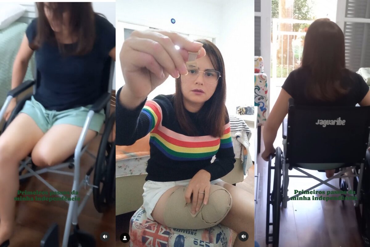 “Minha vida parou”, diz mulher que teve perna amputada após racha “Minha vida parou”, diz mulher que teve perna amputada após racha