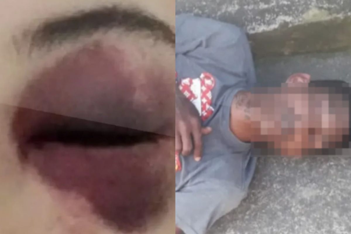 “Safado”: suspeito é espancado após roubar e morder adolescente. Vídeo “Safado”: suspeito é espancado após roubar e morder adolescente. Vídeo